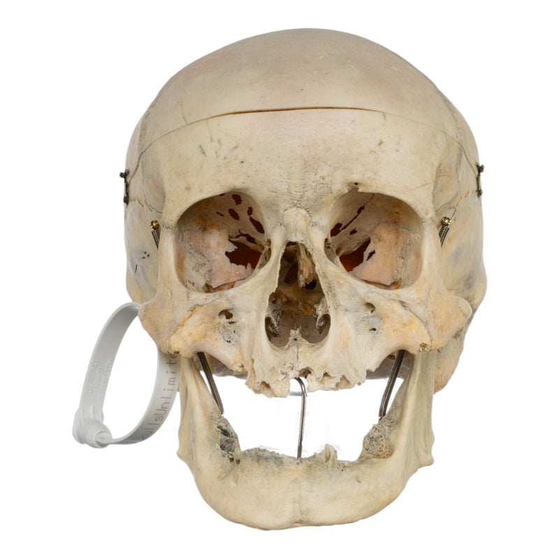 Real Human Skull