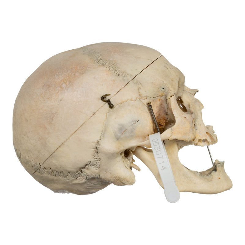 Real Human Skull