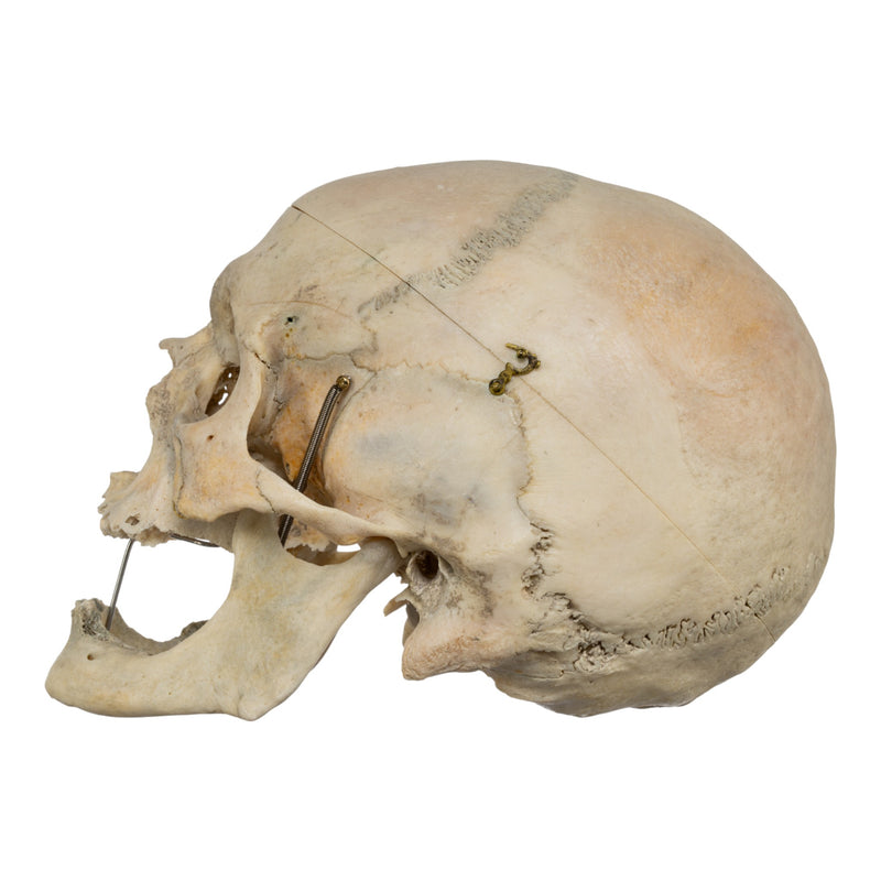 Real Human Skull