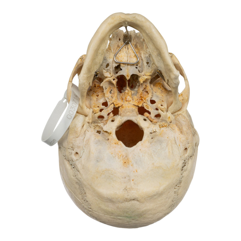 Real Human Skull