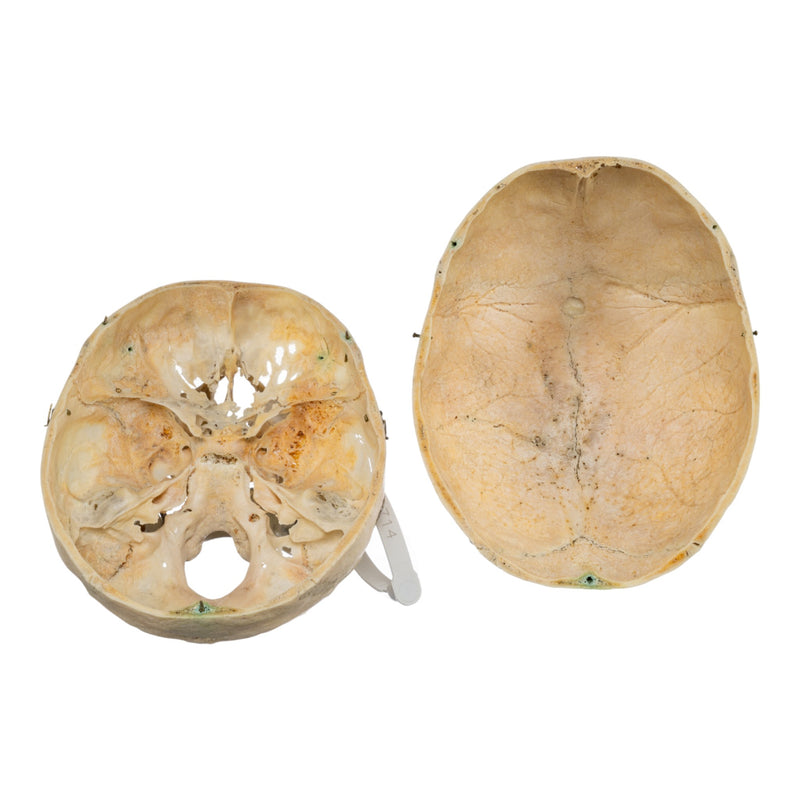 Real Human Skull