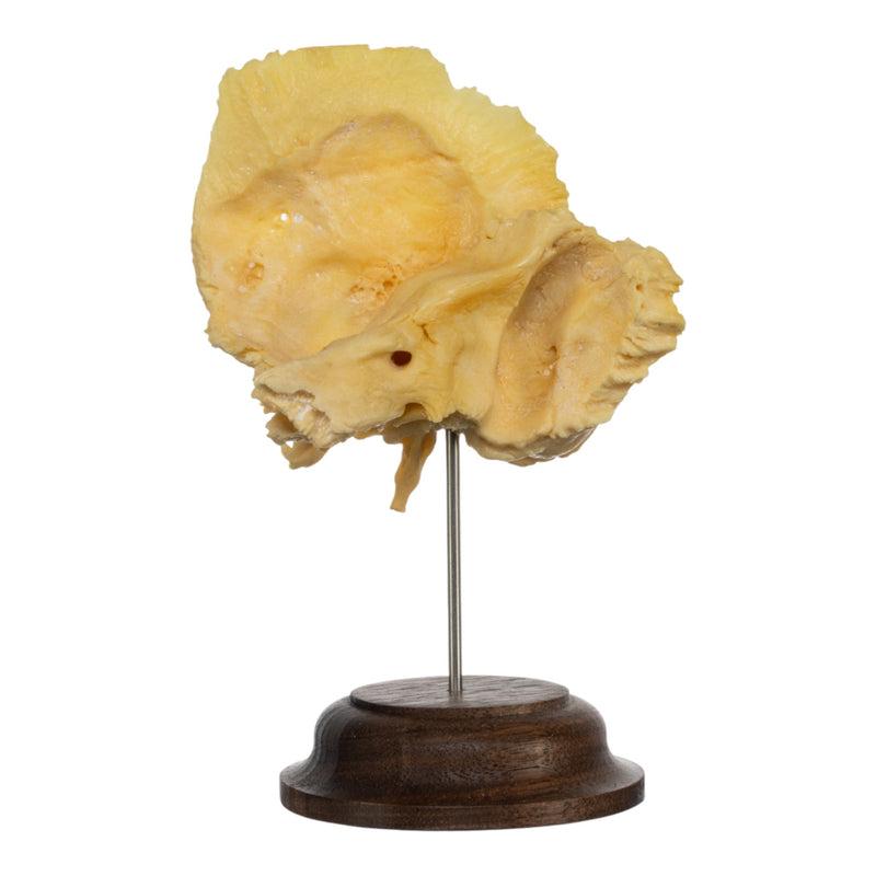 Real Human Temporal Bone on Stand