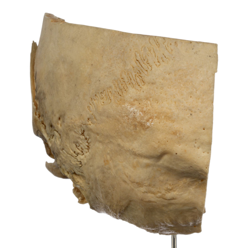 Real Human Partial Skull on Stand