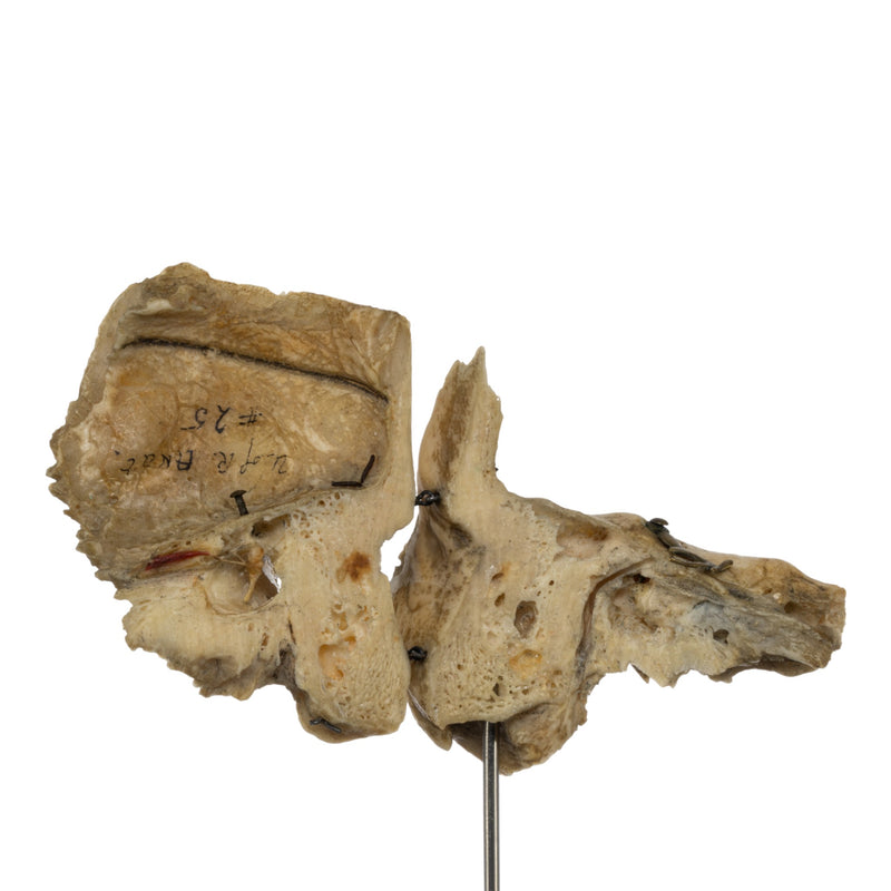 Real Human Articulated Temporal Bone on Stand