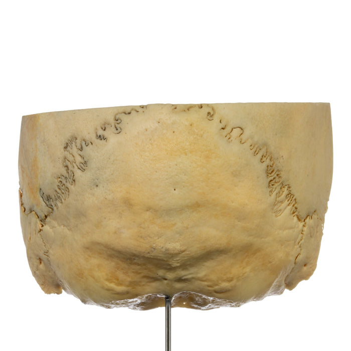 Real Human Partial Skull on Stand