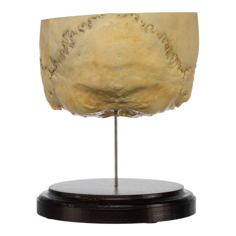Real Human Partial Skull on Stand