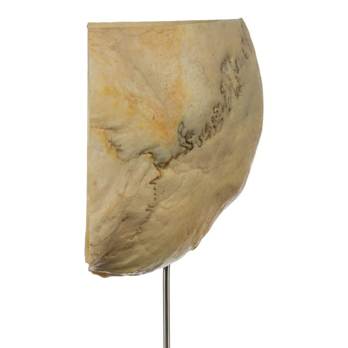 Real Human Partial Skull on Stand