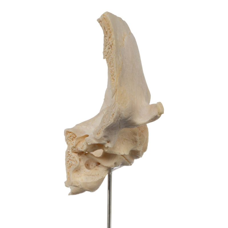 Real Human Partial Skull on Stand