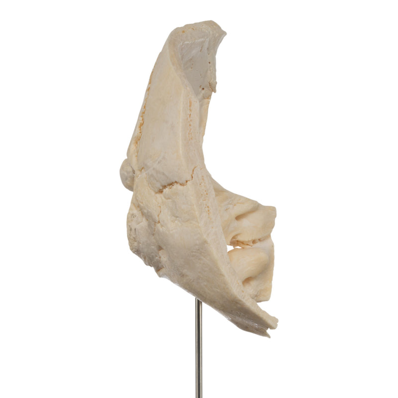 Real Human Partial Skull on Stand