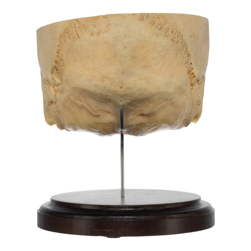Real Human Partial Skull on Stand