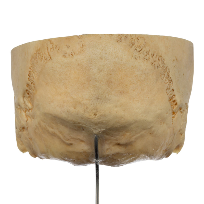 Real Human Partial Skull on Stand