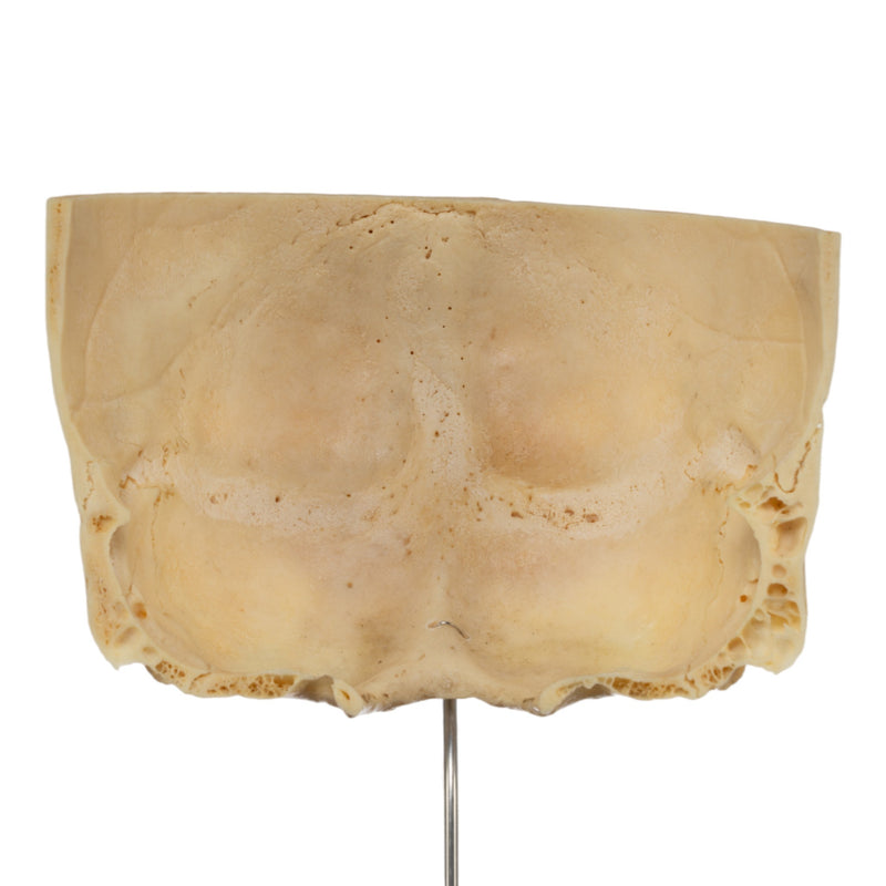 Real Human Partial Skull on Stand