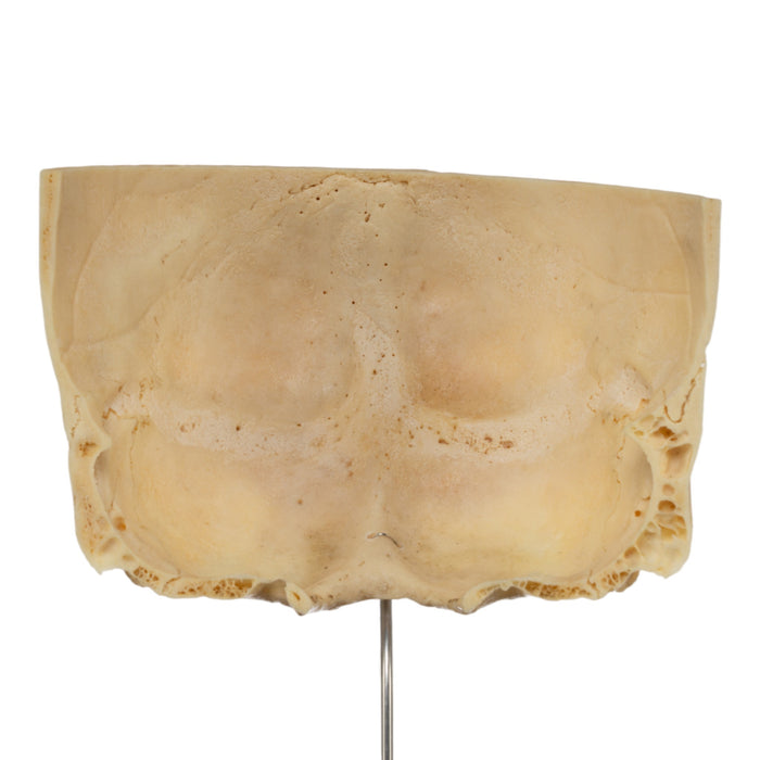 Real Human Partial Skull on Stand