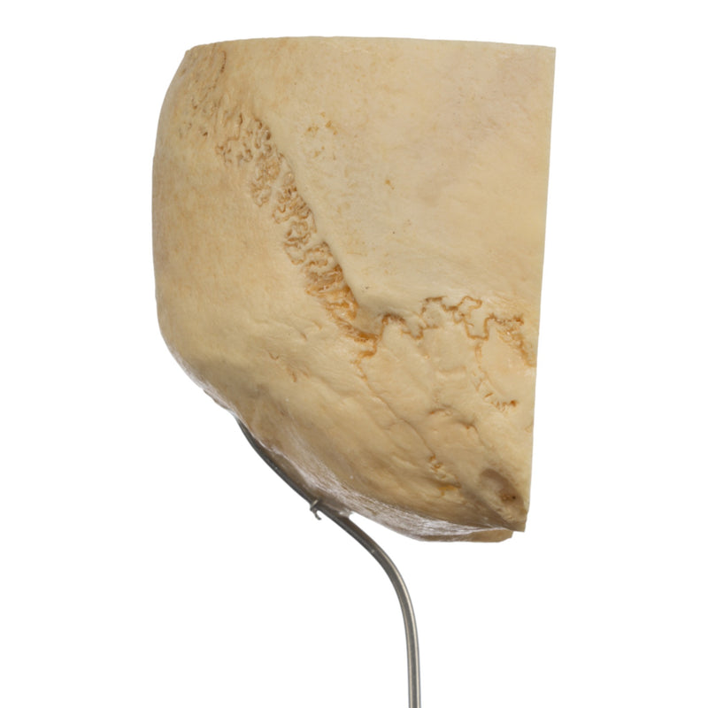 Real Human Partial Skull on Stand