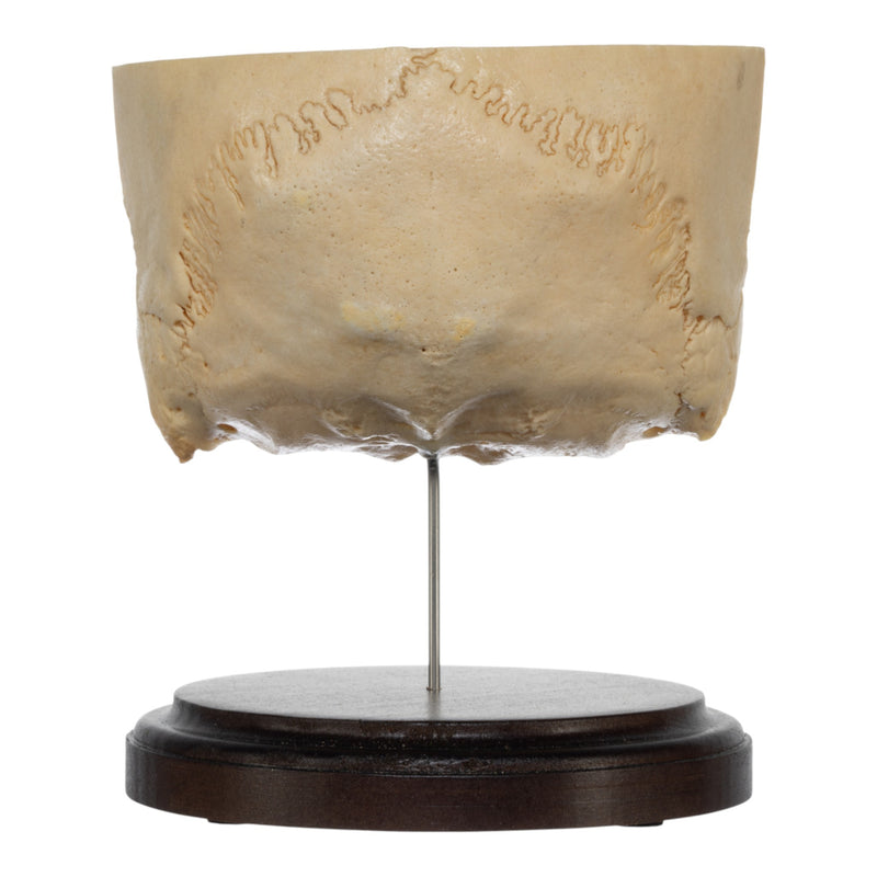 Real Human Partial Skull on Stand