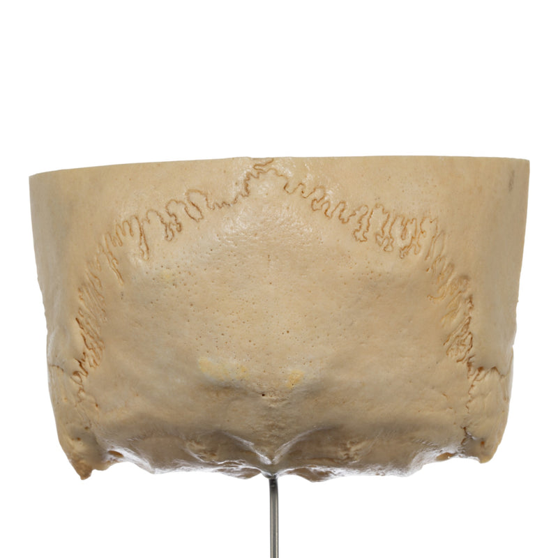 Real Human Partial Skull on Stand