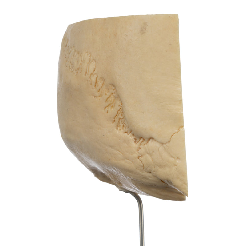 Real Human Partial Skull on Stand