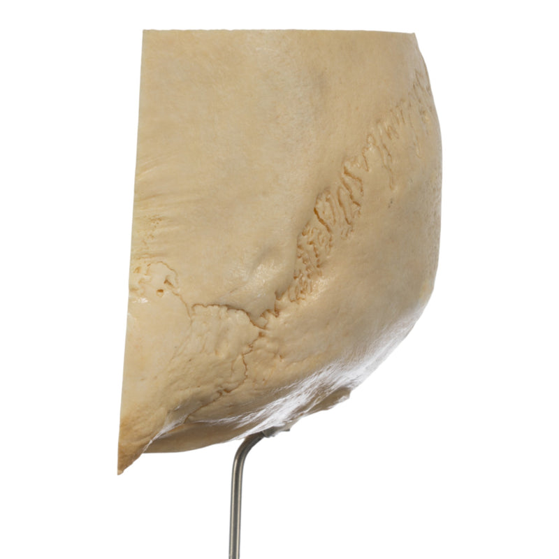 Real Human Partial Skull on Stand