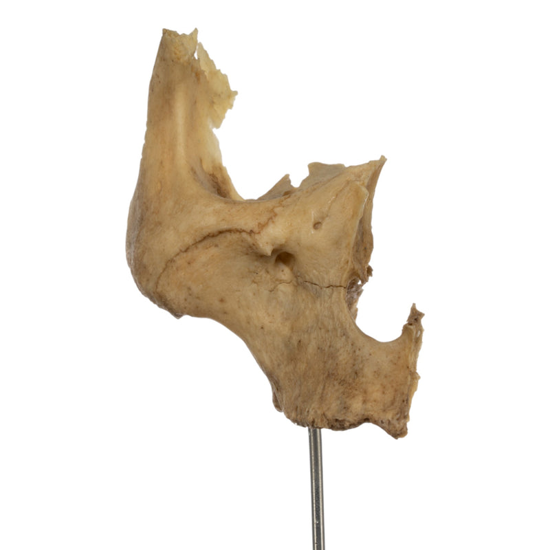 Real Human Partial Skull on Stand