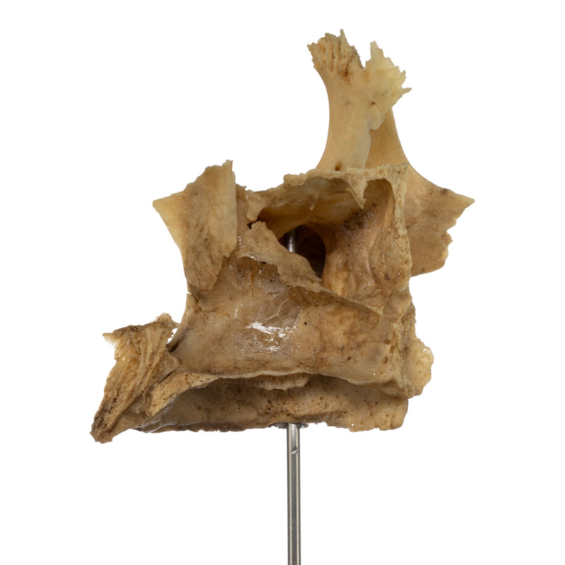 Real Human Partial Skull on Stand