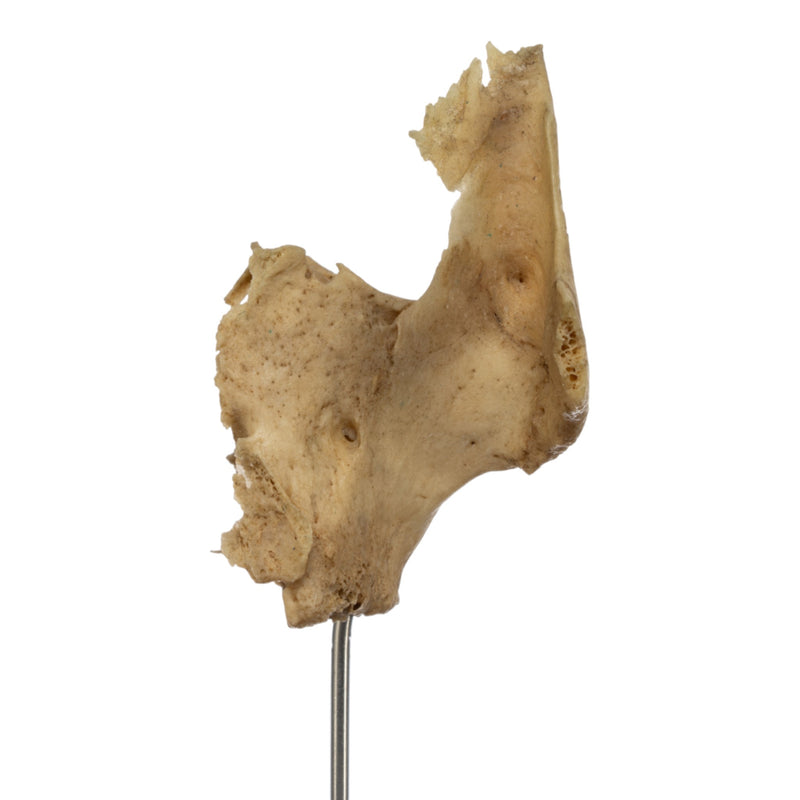 Real Human Partial Skull on Stand