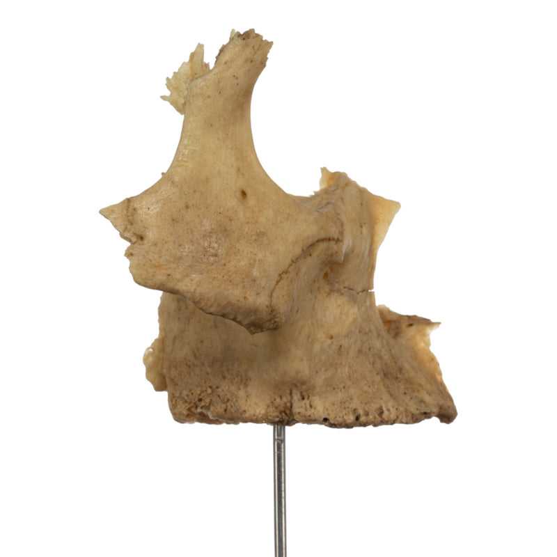 Real Human Partial Skull on Stand