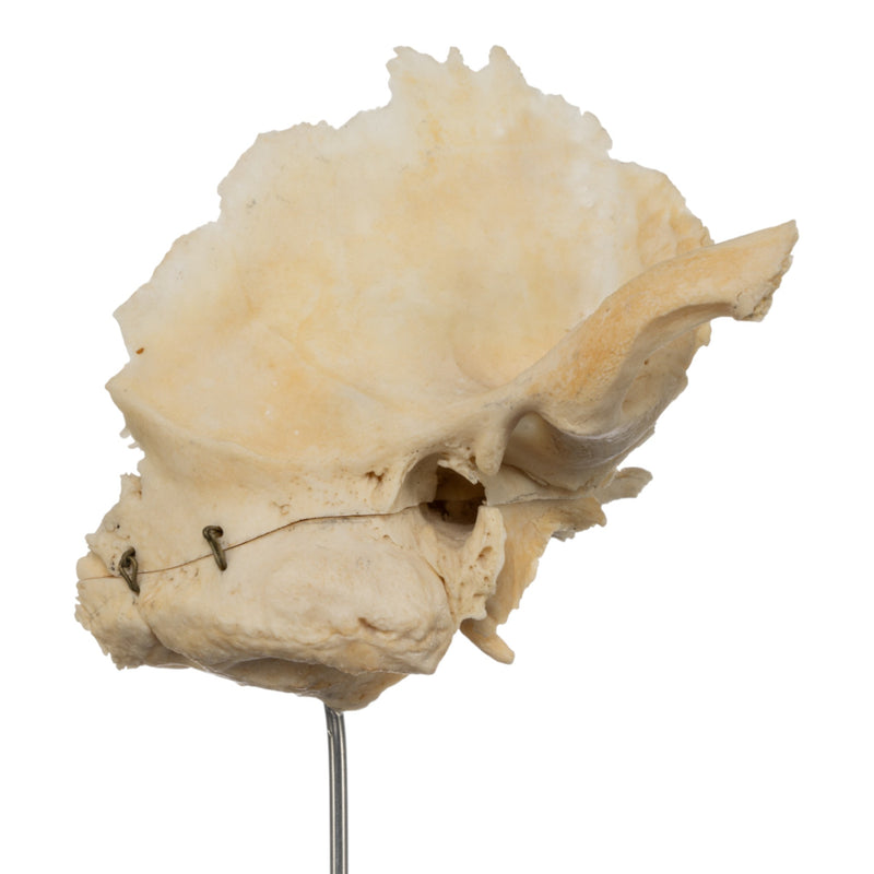 Real Human Articulated Temporal Bone on Stand