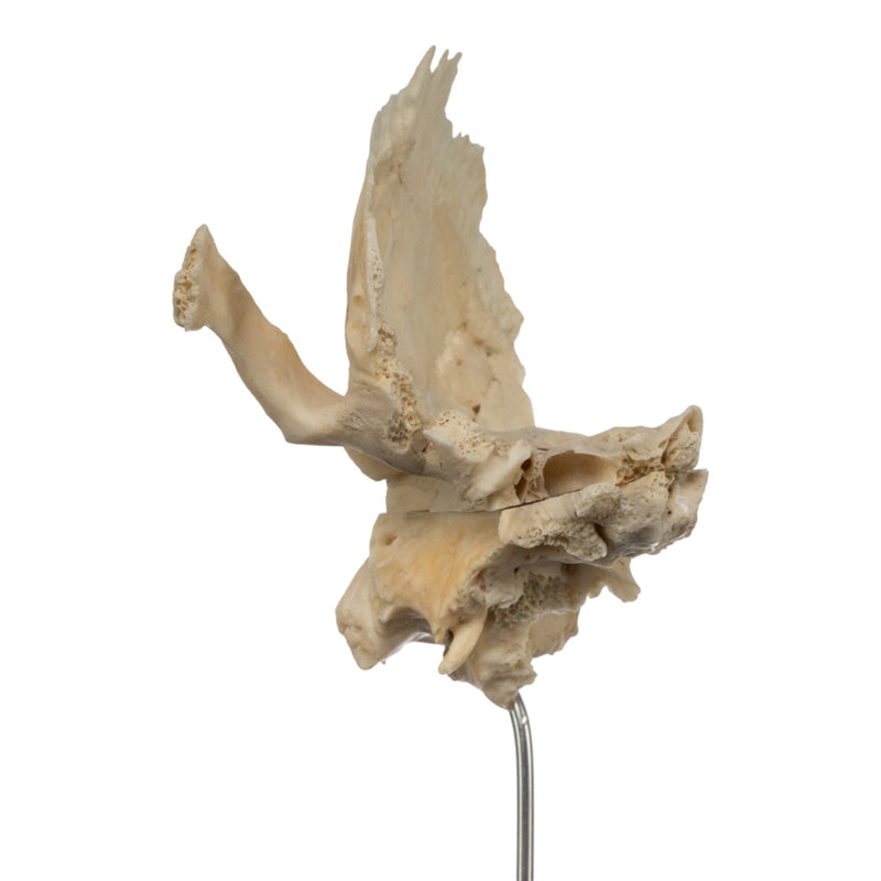 Real Human Articulated Temporal Bone on Stand