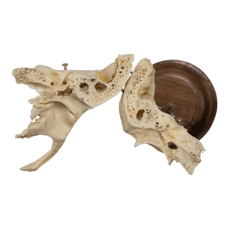 Real Human Articulated Temporal Bone on Stand