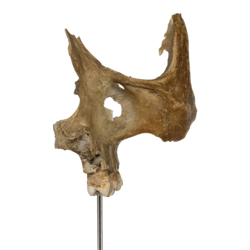 Real Human Partial Skull on Stand