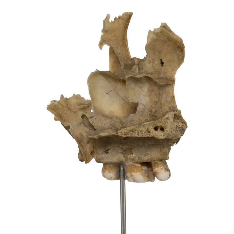 Real Human Partial Skull on Stand
