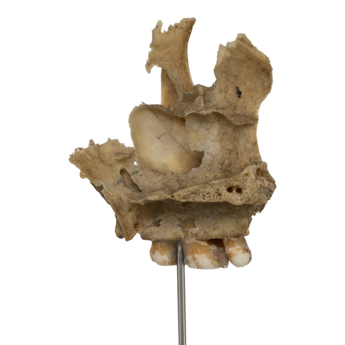 Real Human Partial Skull on Stand