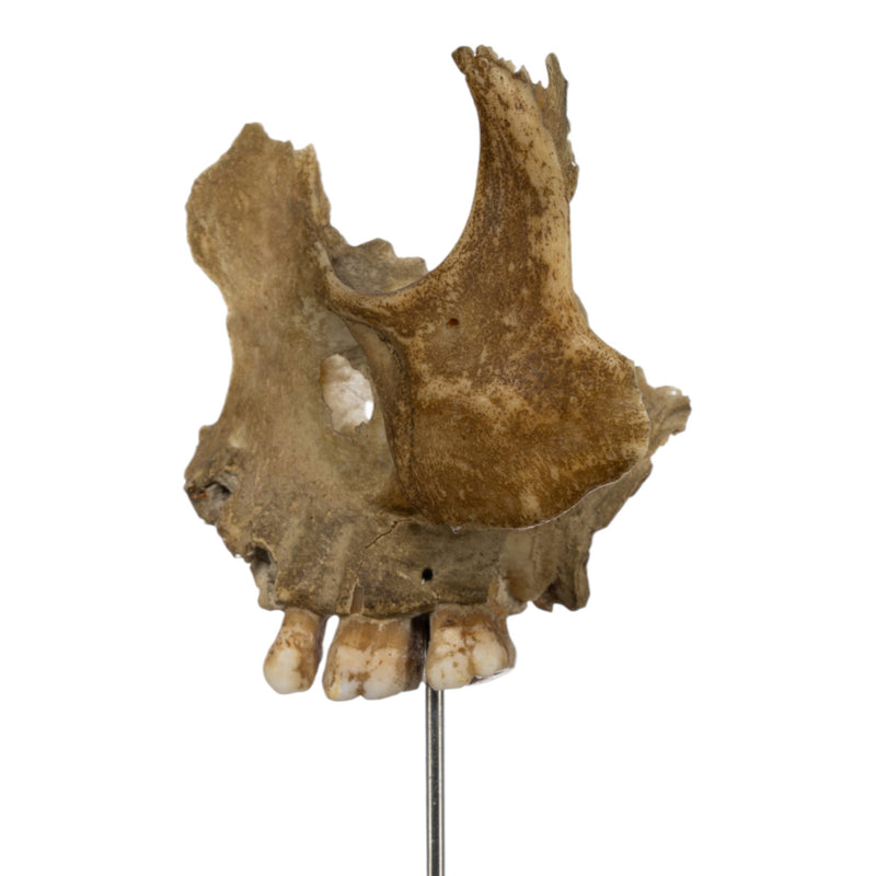 Real Human Partial Skull on Stand