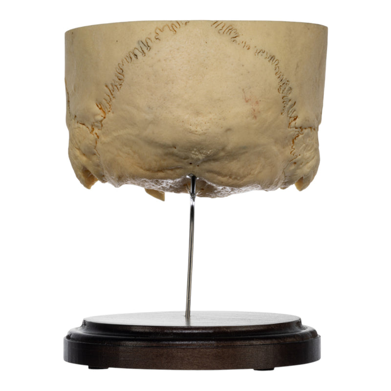 Real Human Partial Skull on Stand