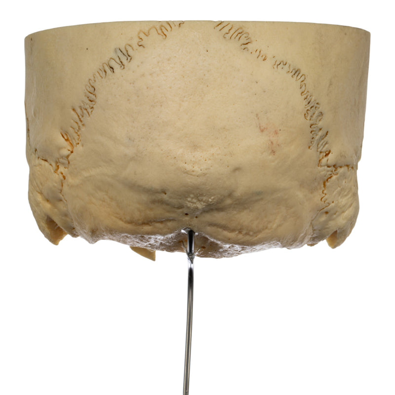 Real Human Partial Skull on Stand
