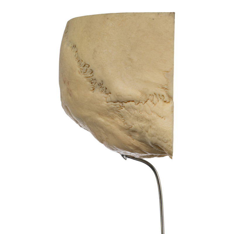 Real Human Partial Skull on Stand