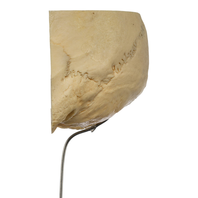 Real Human Partial Skull on Stand