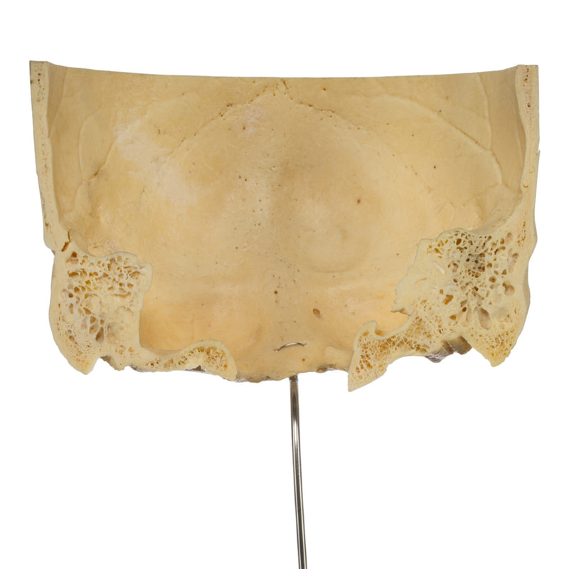 Real Human Partial Skull on Stand