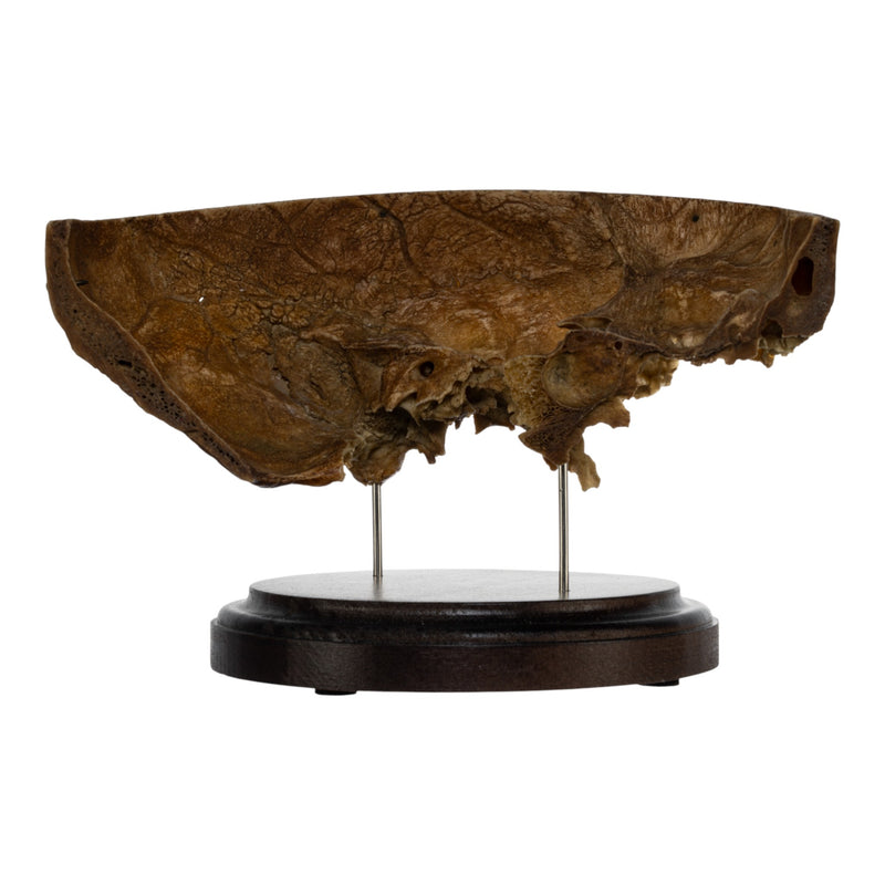 Real Human Partial Skull on Stand