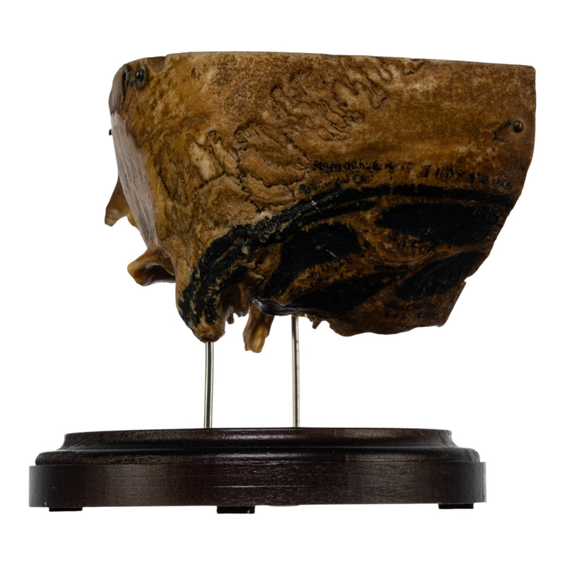 Real Human Partial Skull on Stand