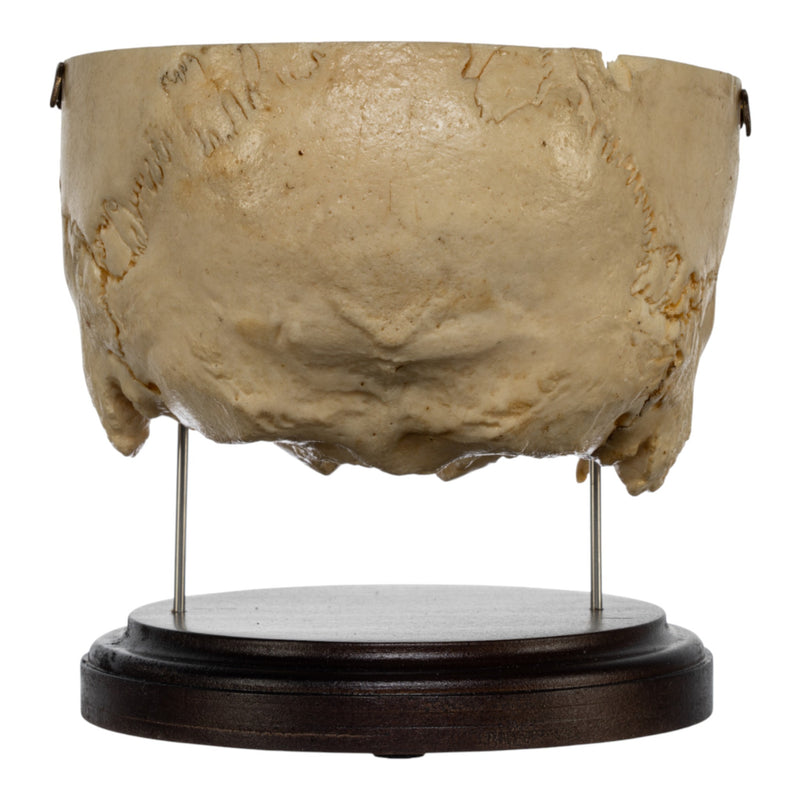 Real Human Partial Skull on Stand