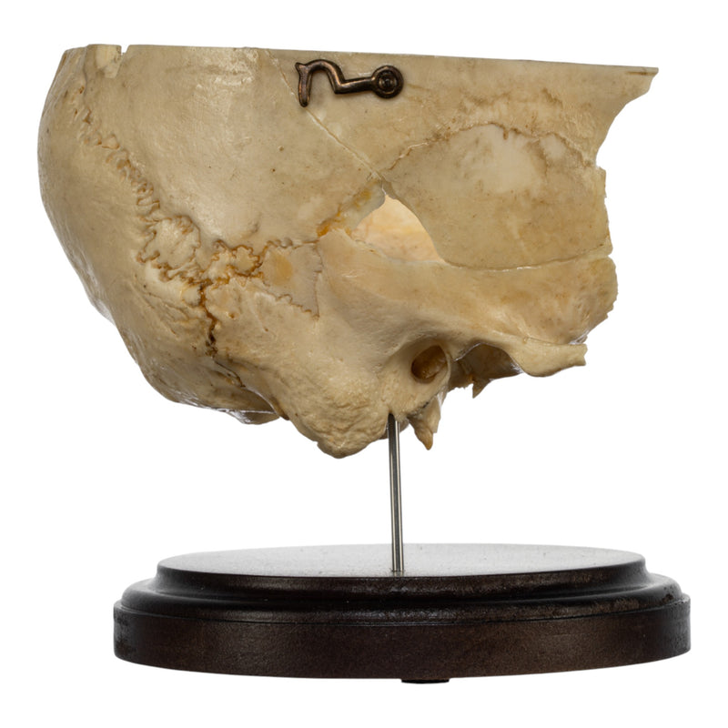 Real Human Partial Skull on Stand