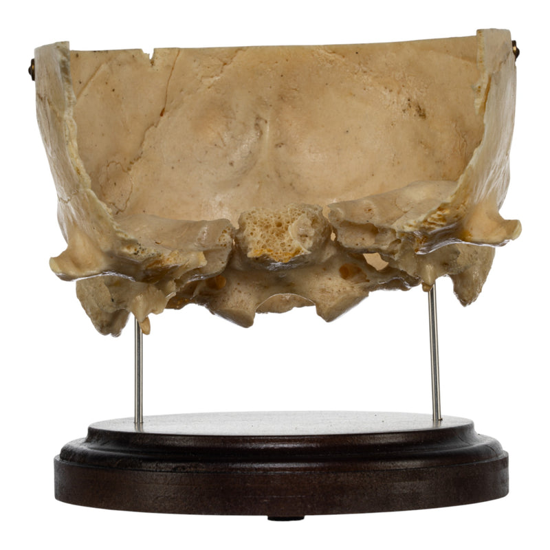 Real Human Partial Skull on Stand