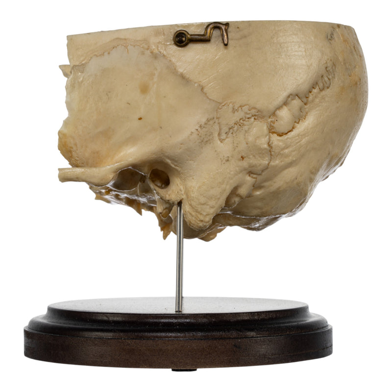 Real Human Partial Skull on Stand