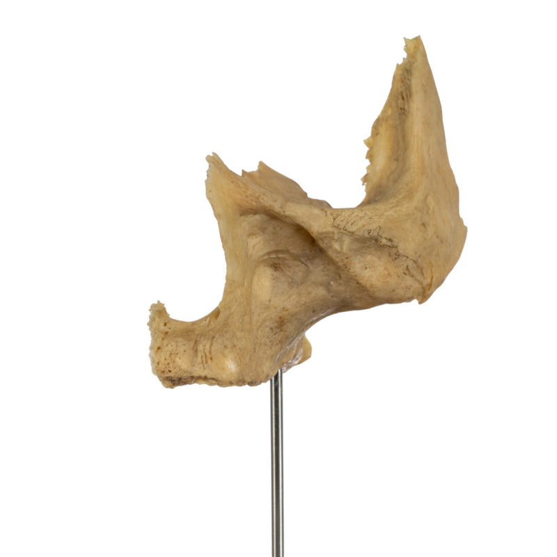 Real Human Partial Skull on Stand
