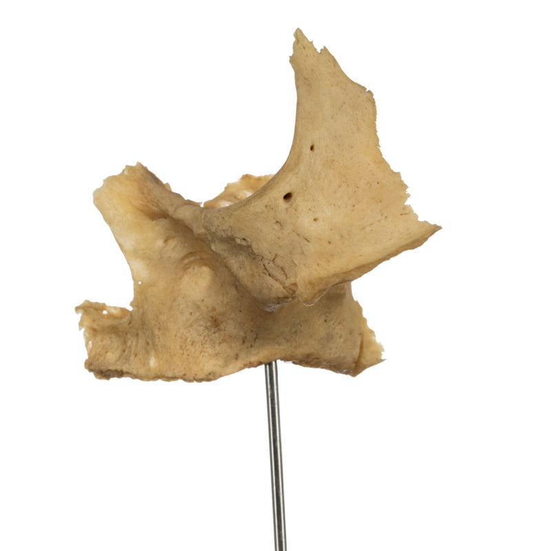 Real Human Partial Skull on Stand