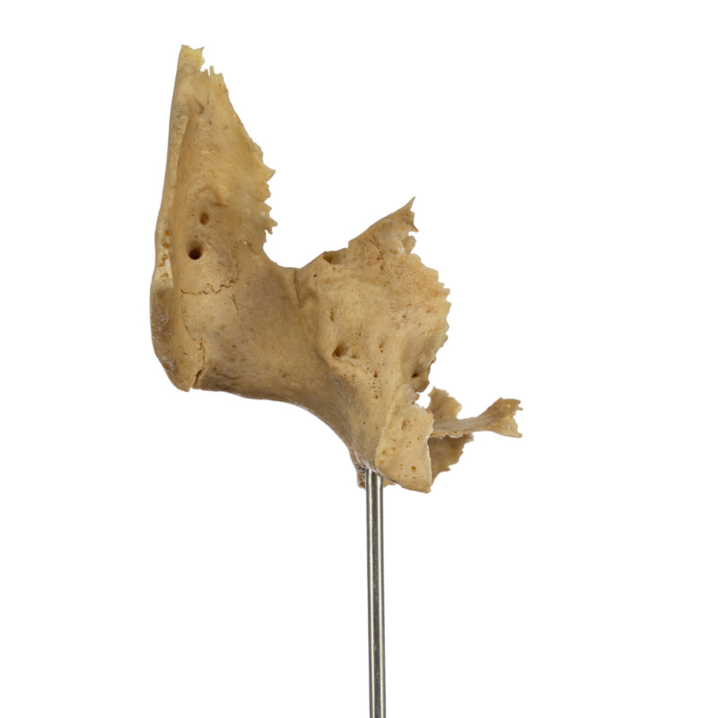 Real Human Partial Skull on Stand