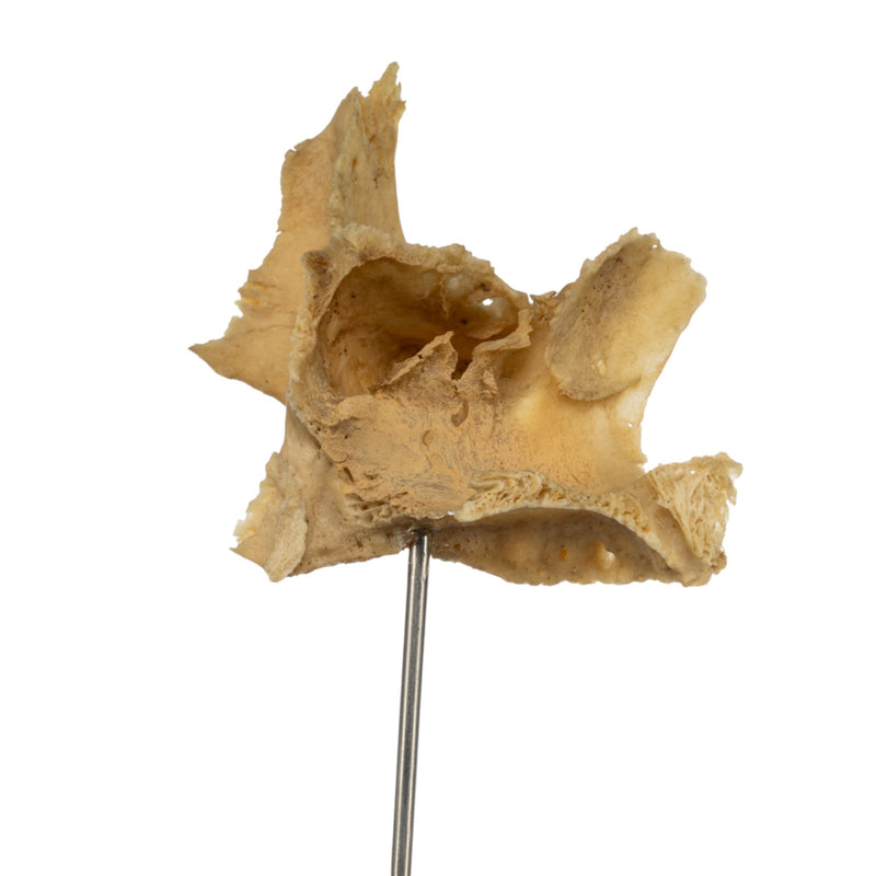 Real Human Partial Skull on Stand