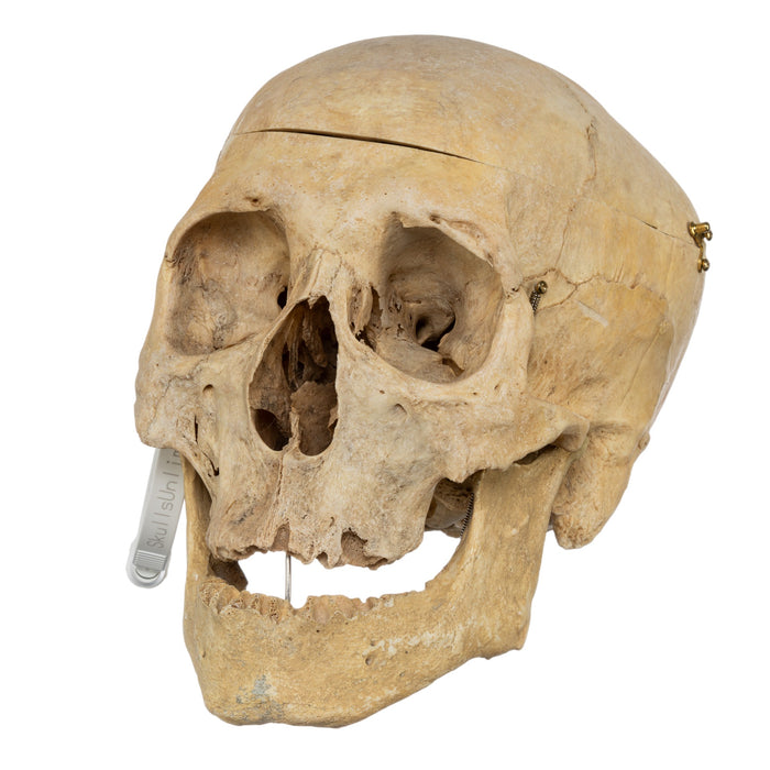 Real Human Skull