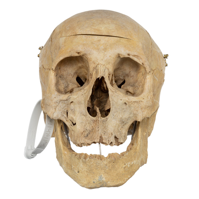 Real Human Skull